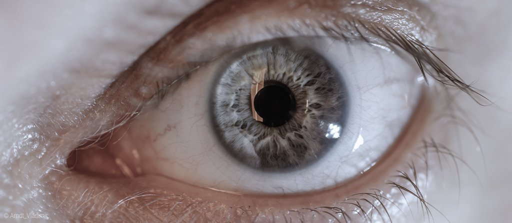 Foto: Nahaufnahme von einem Auge, das weit geöffnet ist.