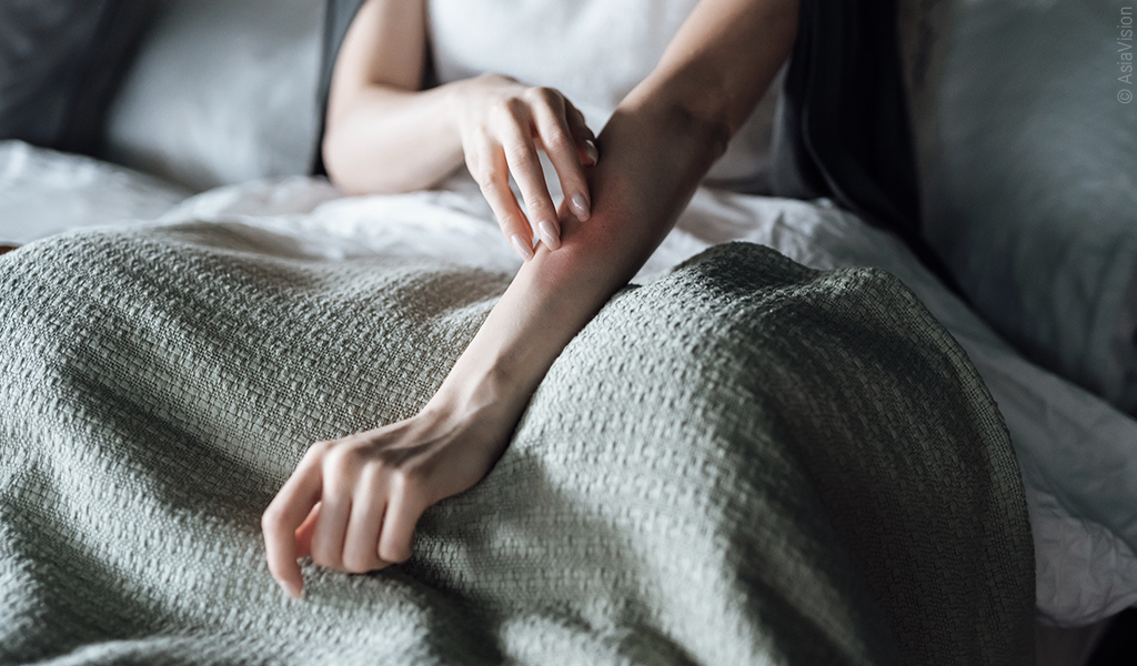 Foto: Eine Person sitzt zugedeckt im Bett und kratzt ihren Unterarm.