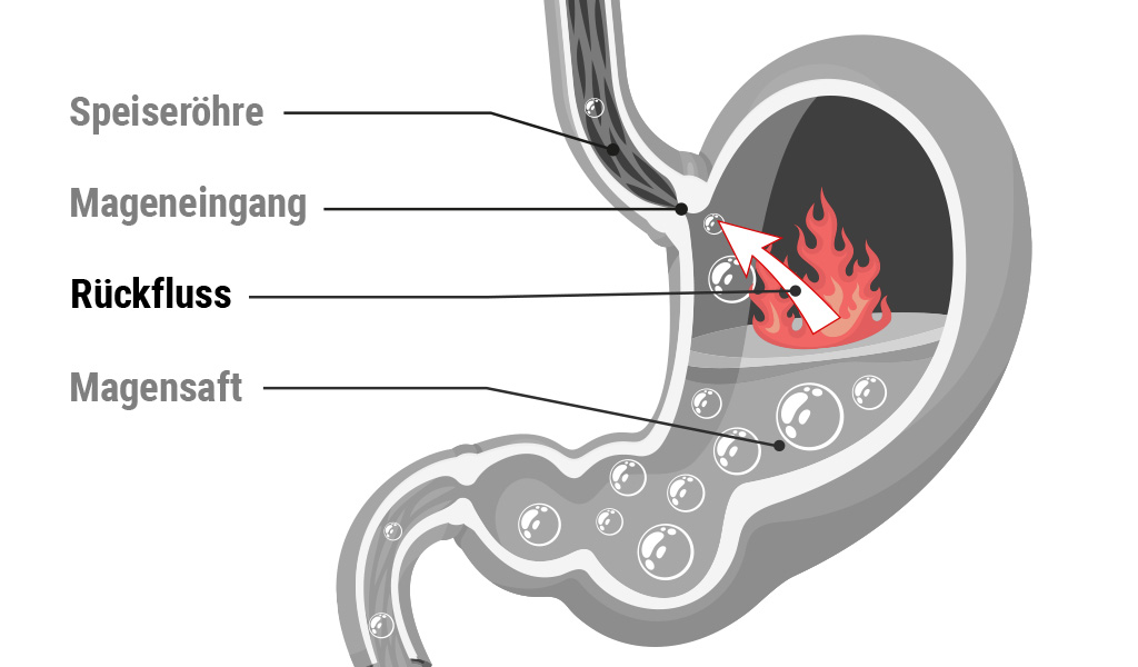 Illustration: Abbildung mit Beschriftung des Magens
